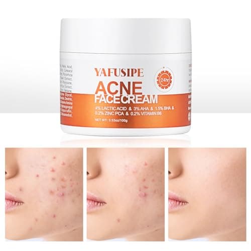 YAFUSIPE Acne Treatment for Face for Hormonal Cystic Stubborn Acne Cream for Sensitive Skin Teens Adults Women Men Spot Pimple Butt Control Rapid Clearing Breakout Overnight Face Blemish Treatment